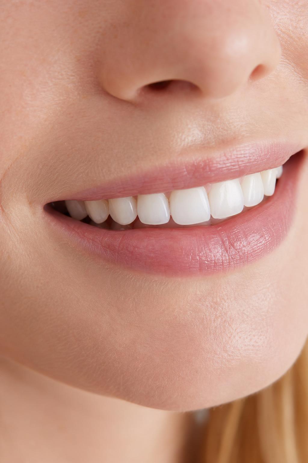 Teeth whitening